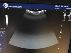 Ultrasound system(Color)｜LOGIQ 7｜GE Healthcare photo21