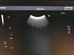 Ultrasound System(Color)｜SSA-790A Aplio XG｜Canon Medical Systems photo18