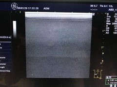 Ultrasound system(Color)｜LOGIQ P5｜GE Healthcare photo18