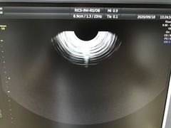 Ultrasound system(Color)｜Voluson S8｜GE Healthcare photo21