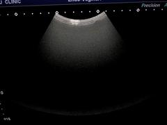 Ultrasound System(Color)｜Xario100 TUS-X100S｜Canon Medical Systems photo13