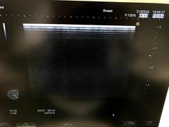 Ultrasound system(Color)｜HI VISION Avius｜Hitachi photo2