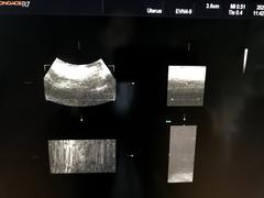 Ultrasound system｜SONOACE R7｜Samsung Medison photo3