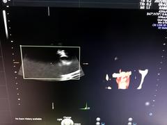 Ultrasound system(Color)｜Voluson E8｜GE Healthcare photo13