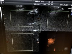 Ultrasound system(Color)｜Voluson E8｜GE Healthcare photo16