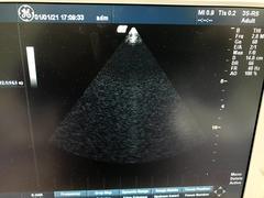 Ultrasound system｜LOGIQ BOOK XP  Enhanced｜GE Healthcare photo3