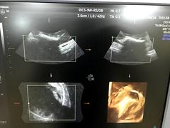 Ultrasound system(Color)｜Voluson S6｜GE Healthcare photo16