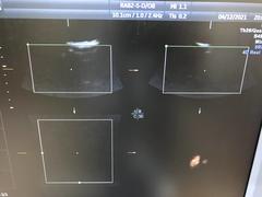 Ultrasound system(Color)｜Voluson E6｜GE Healthcare photo15