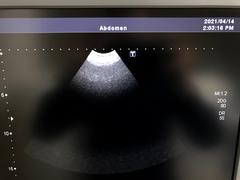 Ultrasound system(Color)｜SSA-660A Xario(LCD)｜Canon Medical Systems photo14
