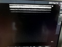 Ultrasound System(Color)｜SonoSite MicroMaxx｜SonoSite photo2