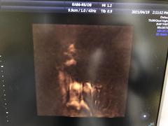 Ultrasound system(Color)｜Voluson S8｜GE Healthcare photo16