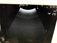 Ultrasound system｜Prosound 6｜Hitachi photo14