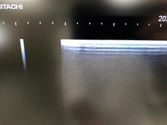 Ultrasound system(Color)｜HI VISION Avius｜Hitachi photo16