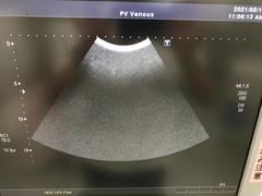 Ultrasound system(Color)｜SSA-660A Xario(LCD)｜Canon Medical Systems photo15