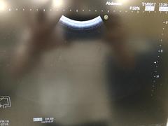 Ultrasound system(Color)｜HI VISION Avius｜Hitachi photo18