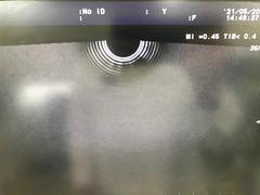 Ultrasound system｜F37｜Hitachi photo18