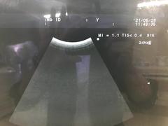Ultrasound system(Color)｜ProSound α7｜Hitachi photo17