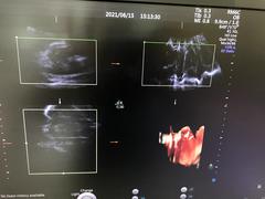 Ultrasound system(Color)｜Voluson E10｜GE Healthcare photo21