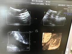 Ultrasound system(Color)｜Voluson S6｜GE Healthcare photo17