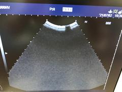 Ultrasound system(Color)｜EUB-7000HV｜Hitachi photo13