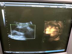 Ultrasound system(Color)｜Voluson 730 Expert｜GE Healthcare photo17