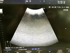 Ultrasound system｜F37｜Hitachi photo15