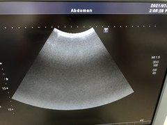 Ultrasound system(Color)｜SSA-660A Xario(LCD)｜Canon Medical Systems photo14