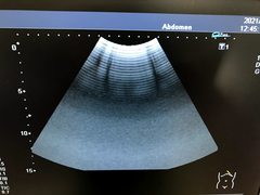 Ultrasound system(Color)｜SSA-580A Nemio XG｜Canon Medical Systems photo18