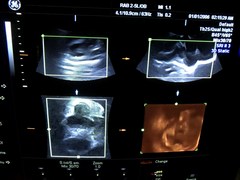 Ultrasound system(Color)｜VOLUSON 730PRO｜GE Healthcare photo21