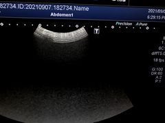 ｜Aplio 400 TUS-A400｜Canon Medical Systems photo12