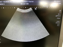 ｜Aplio 400 TUS-A400｜Canon Medical Systems photo15