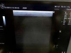 Ultrasound system(Color)｜LOGIQ P6｜GE Healthcare photo2