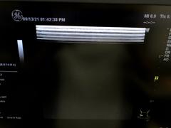 Ultrasound system(Color)｜LOGIQ P6｜GE Healthcare photo2