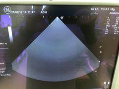 Ultrasound system(Color)｜LOGIQ P5｜GE Healthcare photo4
