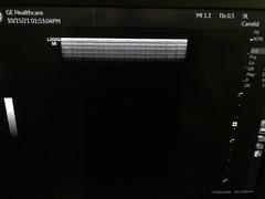 超音波診断装置｜LOGIQ S8 XDclear2.0+｜GEヘルスケアの写真18枚目
