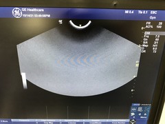 超音波診断装置｜LOGIQ e Premium｜GEヘルスケアの写真18枚目