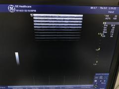 Ultrasound system(Color)｜LOGIQ e Premium Pro｜GE Healthcare photo13