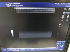 超音波診断装置｜LOGIQ e Premium Pro｜GEヘルスケアの写真14枚目