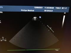 Ultrasound system｜iE33｜Philips photo21