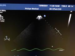 Ultrasound system｜iE33｜Philips photo16
