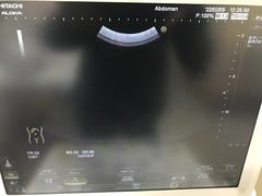 超音波診断装置｜Noblus｜日立製作所の写真14枚目