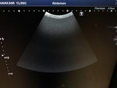 超音波診断装置（カラードプラ）｜Xario100 TUS-X100｜キヤノンメディカルシステムズの写真15枚目