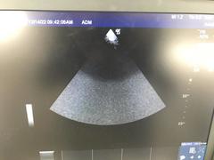 超音波診断装置｜LOGIQ e Premium｜GEヘルスケアの写真21枚目