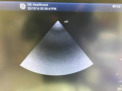 超音波診断装置｜LOGIQ S7 with XDclear｜GEヘルスケアの写真21枚目