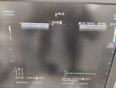 超音波診断装置｜ARIETTA 60｜日立製作所の写真21枚目