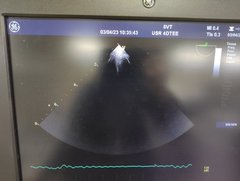 超音波診断装置(カラードプラ)ＬＣＤ｜Vivid E9 with XDclear｜GEヘルスケアの写真21枚目