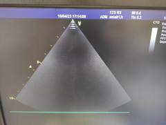 超音波診断装置（カラードプラ）｜Vivid S6｜GEヘルスケアの写真21枚目