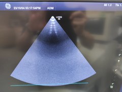 超音波診断装置｜LOGIQ S8 XDclear｜GEヘルスケアの写真19枚目
