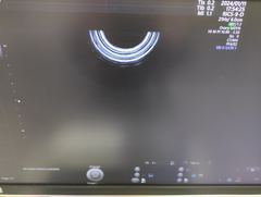 Ultrasound system(Color)｜Voluson E10｜GE Healthcare photo21
