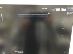Ultrasound system(Color)｜HI VISION Avius｜Hitachi photo19